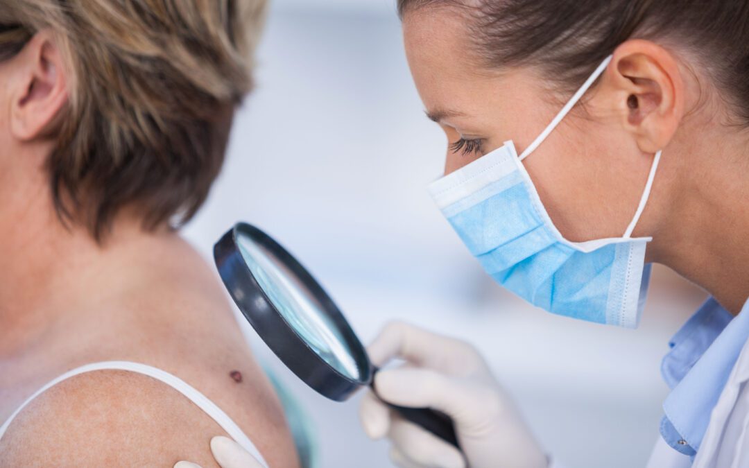 Dermatologist examining mole of female patient with magnifying glass in clinic